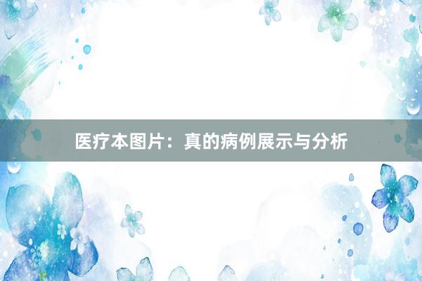 医疗本图片：真的病例展示与分析